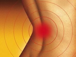 Schmerzen im unteren Rücken mit Osteochondose