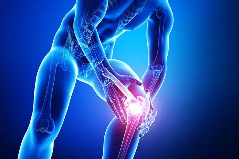 Symptome einer Arthrose